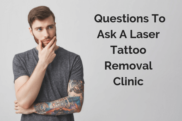 Laser tattoo removal questions gold coast